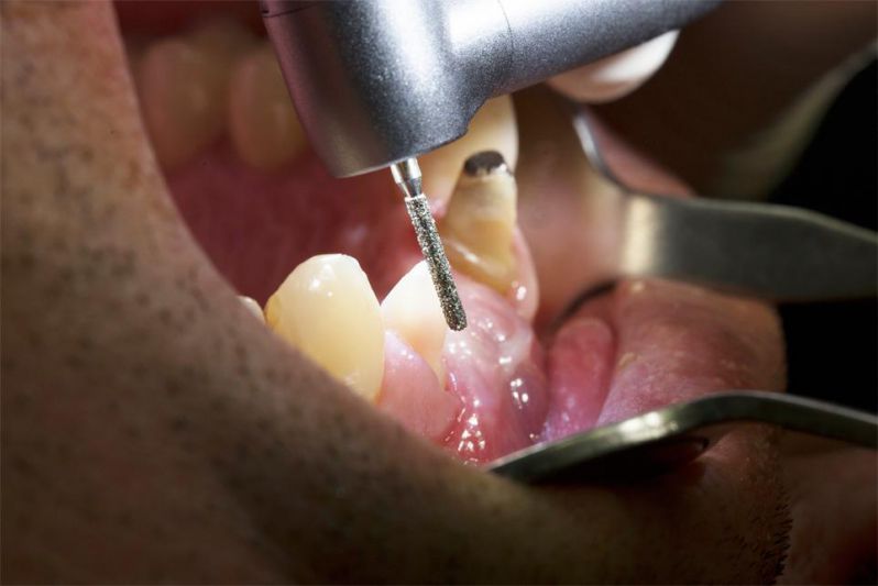 Tốc độ khuyến nghị