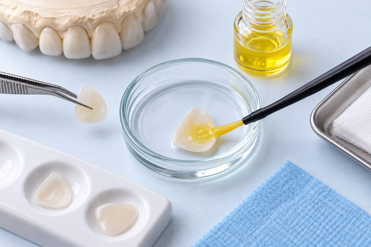 Minh họa axit HF etching sứ là gì