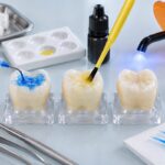 Minh họa kỹ thuật dán với universal bond ở ba chế độ etching
