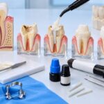 Minh họa tái tạo cùi răng bằng composite, chỉ định và kỹ thuật